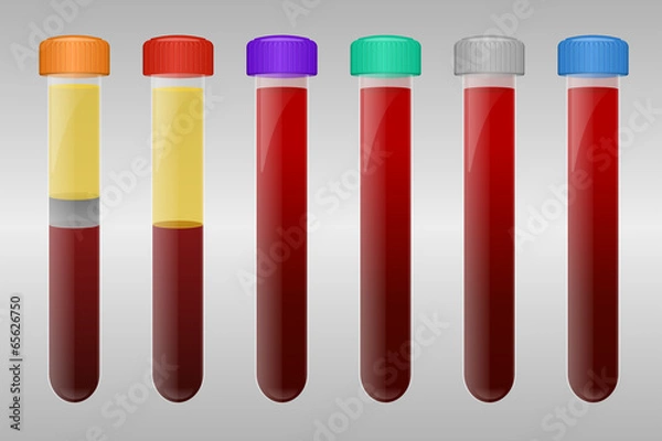 Obraz Blood sample tubes