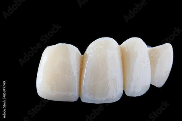 Obraz Bridge denture