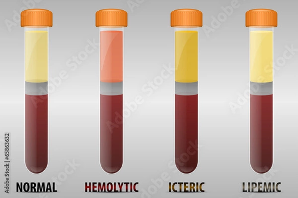 Obraz Blood serum common types
