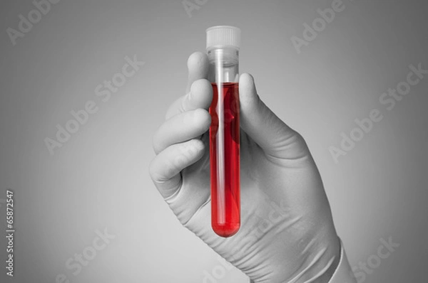 Obraz Doctor's hand with blood sample
