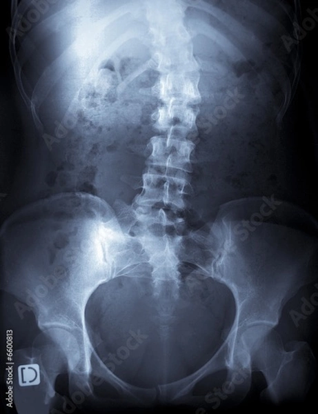 Obraz x-ray of a young female spine
