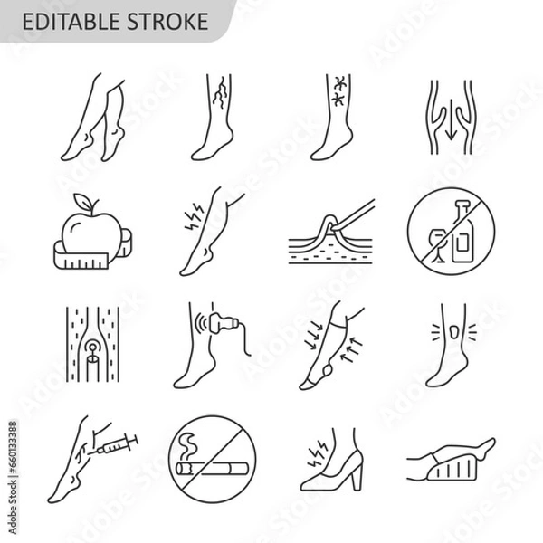 Obraz Varicose veins line icon set. Leg veins thrombosis disease. Treatment, surgery and prevention of varicose veins vector sign with ultrasaund, ulcer, phlebectomy, laser coagulation. Editable stroke.