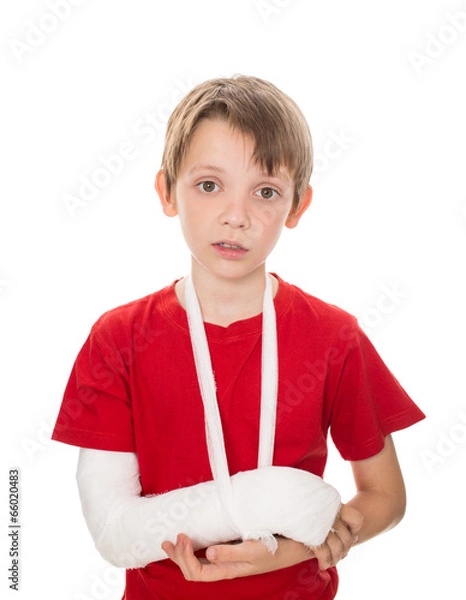 Fototapeta boy with a broken arm
