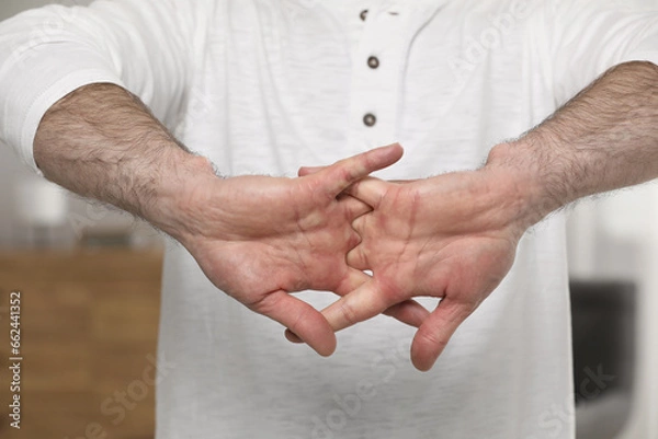 Fototapeta Man cracking his knuckles on blurred background, closeup. Bad habit
