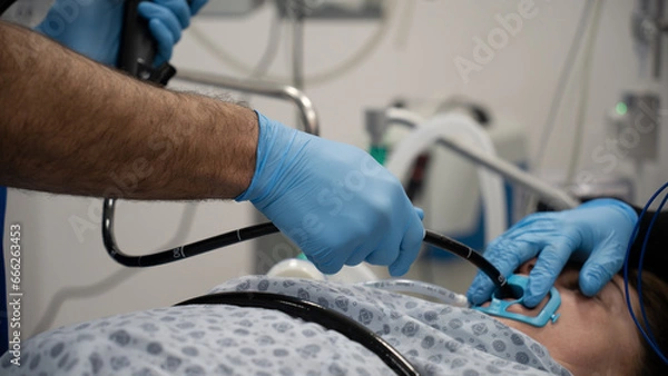 Obraz Endoscopy. doctor doing endoscopy before surgery