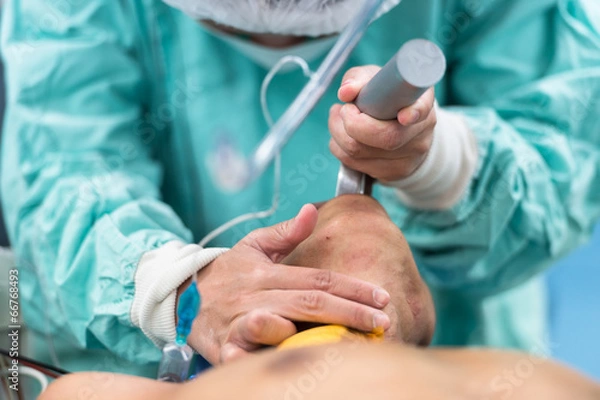 Obraz insertion endotracheal tube