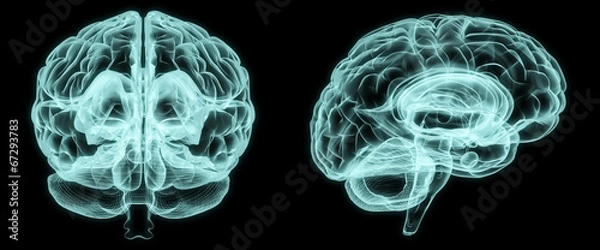 Obraz X-ray front and side brain