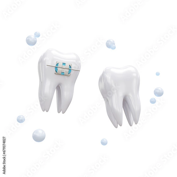 Fototapeta 3d tooth isolated on transparent background. Teeth metal braces. Teeth alignment. Render.  PNG. Dentistry, medicine concept. 3D rendering, ui, ux. Teeth. Health. Shapes