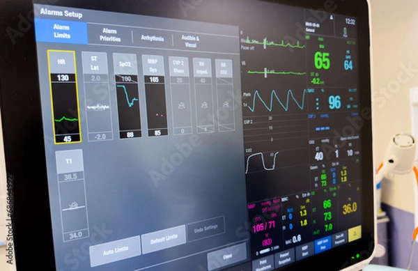Fototapeta Hospital monitors display vital signs: hemodynamics, heart rate, blood pressure, temperature, oxygen saturation, and end-tidal CO2 for patient health assessment