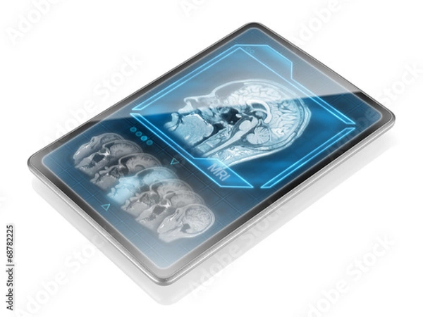 Obraz Tablet with MRI scan isolated on white background