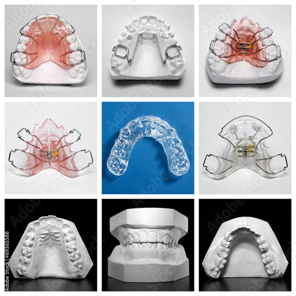 Obraz Essix retainer surrounded by orthodontic appliances and models