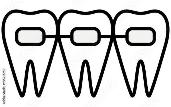 Fototapeta 歯科：歯並びの矯正で使う矯正器具、メタルブラケット