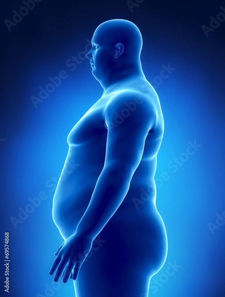 Obraz Obesity concept in x-ray left view