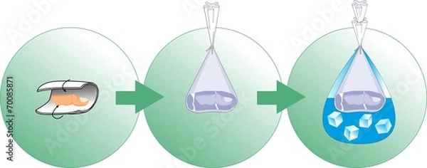 Obraz Erste Hilfe / Amputation