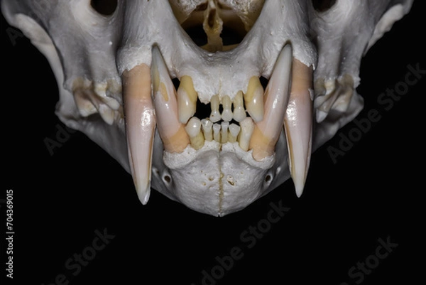 Obraz Teeth abrasion