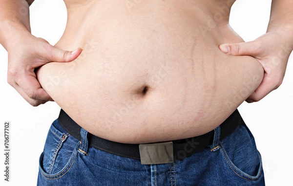 Obraz Fat Belly