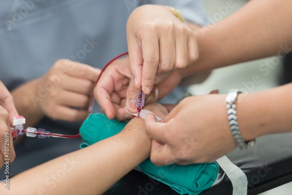 Obraz stabilize arterial line