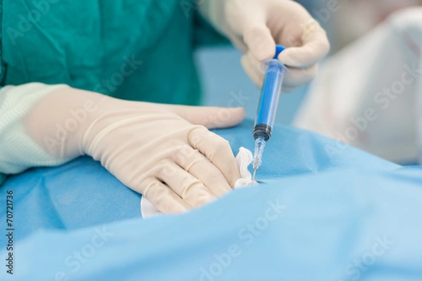 Obraz puncture internal carotid vein