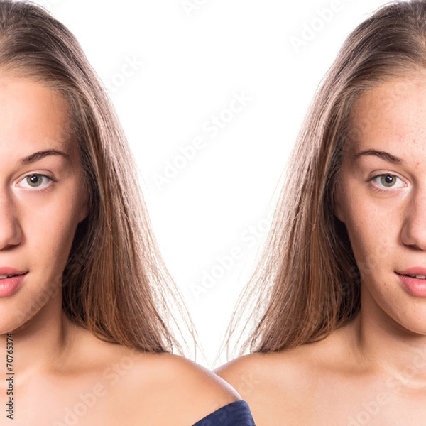 Obraz Before And After Make Up Face Skin