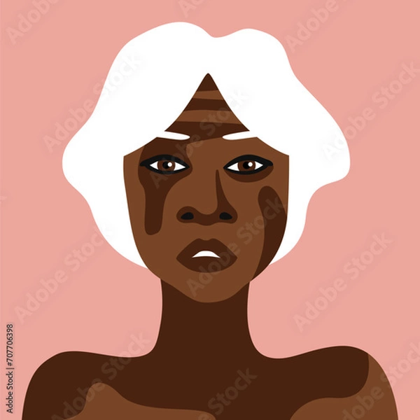 Obraz Elderly African American woman with vitiligo in minimalistic style vector