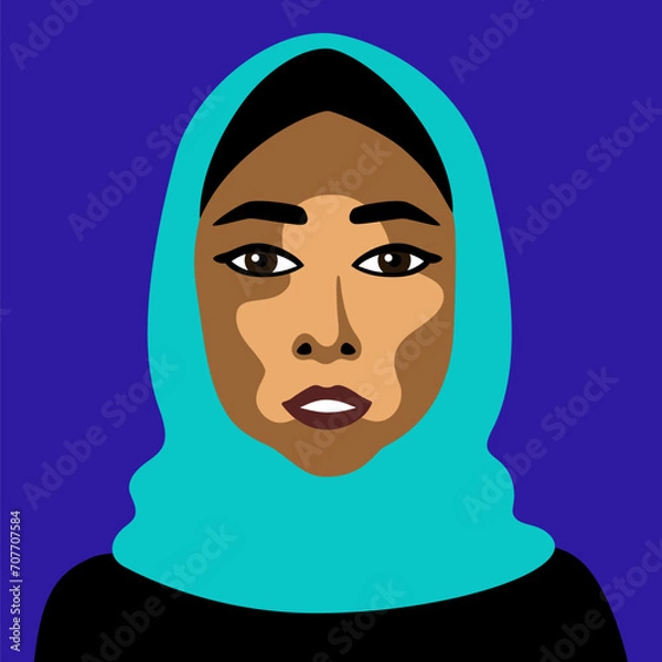 Obraz Muslim woman in headscarf with skin disease vitiligo in minimalistic style vector image