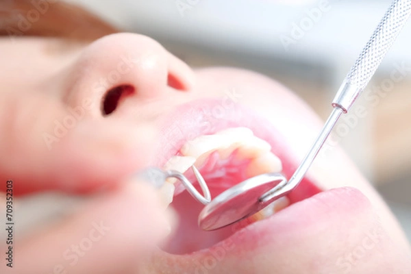 Fototapeta 歯科治療を受ける女性