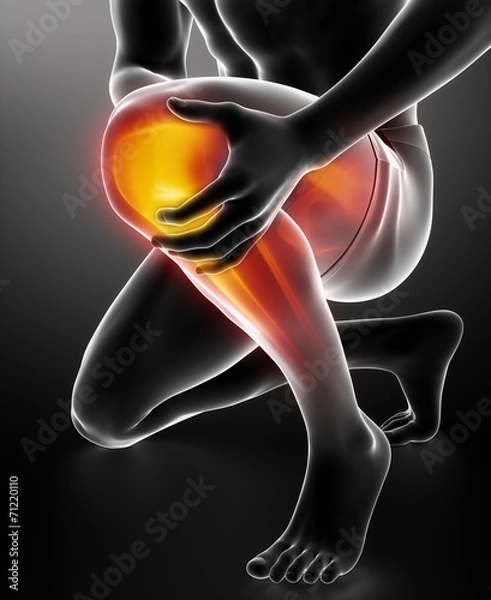 Fototapeta Man knee injured and sprained