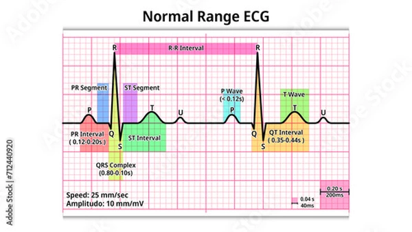 Fototapeta Normal Range ECG - PR Interval, QRS Complex, QT Interval, P and T Wave - Electrocardiogram Medical Vector Illustration