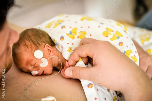 Obraz Wcześniaki w więzi