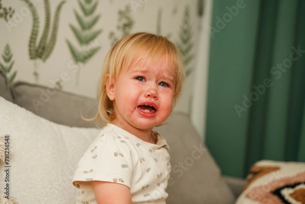 Fototapeta The toddler child is crying and screaming with a red face at home