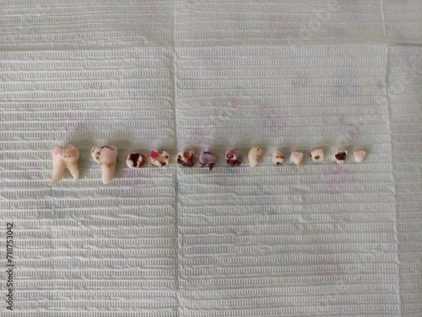 Obraz Extracted teeth on a napkin
