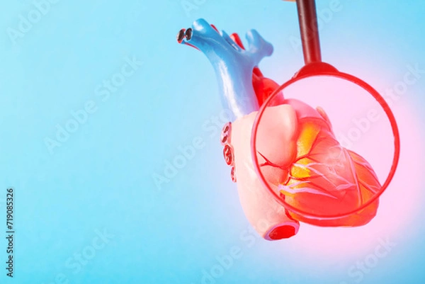 Fototapeta Medical mock-up of a heart under a magnifying glass on a blue background. Heart disease concept, inflammation of the heart muscle, myocardial infarction, coronary heart disease. Copy space for text