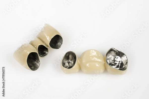 Obraz Mostki VMK (NEM)