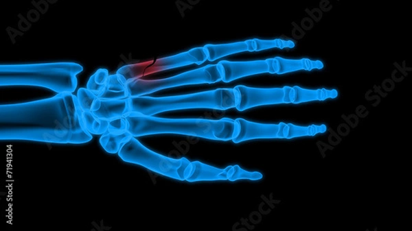 Obraz X-ray hand