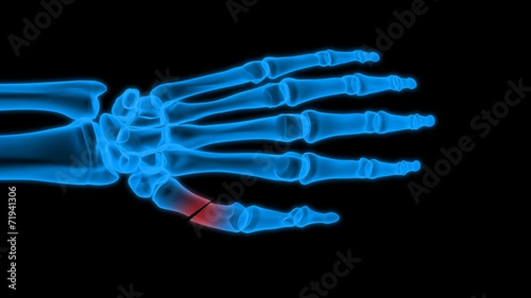 Fototapeta X-ray hand