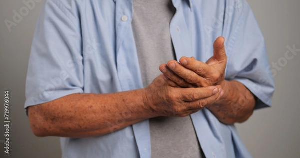 Fototapeta An Asian man has tingling and numbness in his hand which causes beriberi.