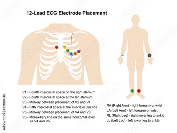 Obraz Electrocardiogram. Placement of 12-lead ECG electrodes on the human chest and body with main parts labeled. Heart cardiogram. Vector illustration in flat style isolated on white background