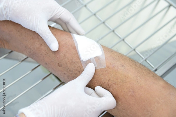 Fototapeta Wound sealed with plaster