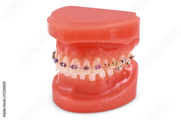 Obraz braces model