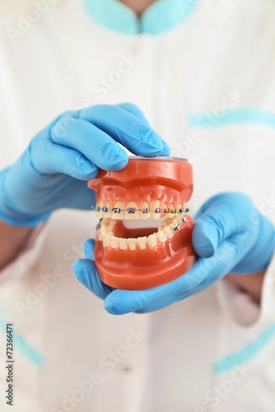 Obraz braces model