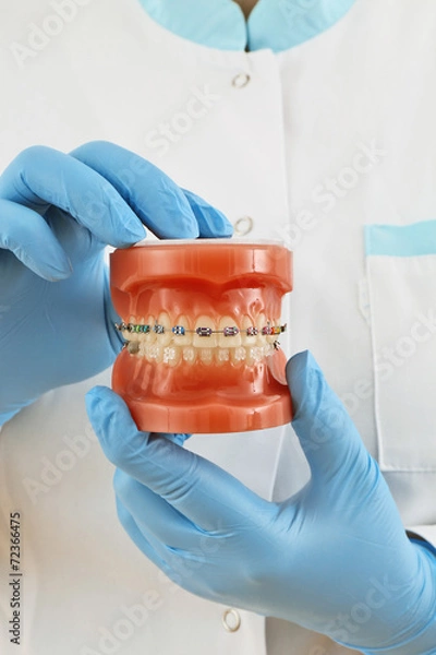 Obraz braces model