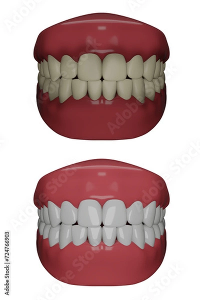 Obraz Dirty and Clean teeth. 3d Render.
