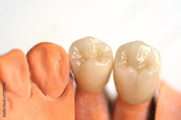 Obraz Korona dentystyczna