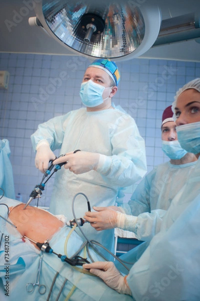 Obraz gallbladder removal