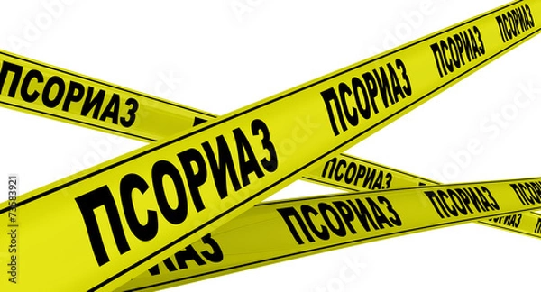 Fototapeta Псориаз. Желтая оградительная лента