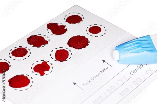 Obraz A Completed Blood Spot test card with droplets of blood for hormone testing