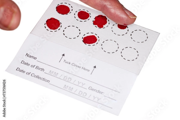 Obraz Blood Spot test card with droplets of blood for hormone testing