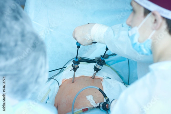 Obraz gallbladder removal