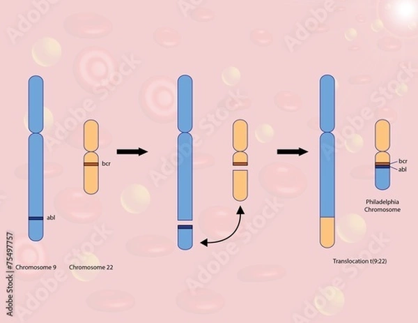 Obraz Philadelphia chromosome