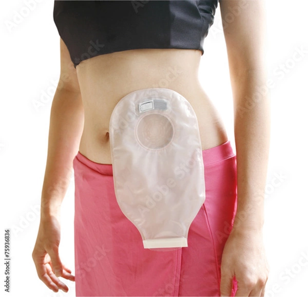 Fototapeta 介護用品を装着した女性